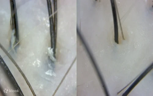 AI-powered scalp diagnosis and electron microscope analysis